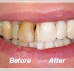 cosmetic dentistry